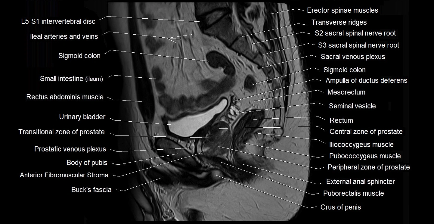 male pelvis sagittal cross sectional anatomy 3T mri image 26.webp